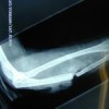 13's injuries and MORE!